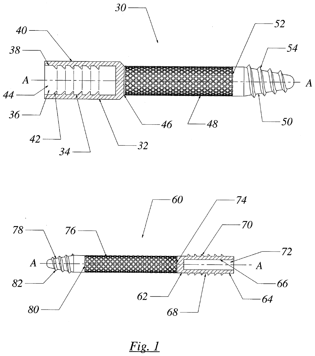 Long Bone Fracture Reduction System