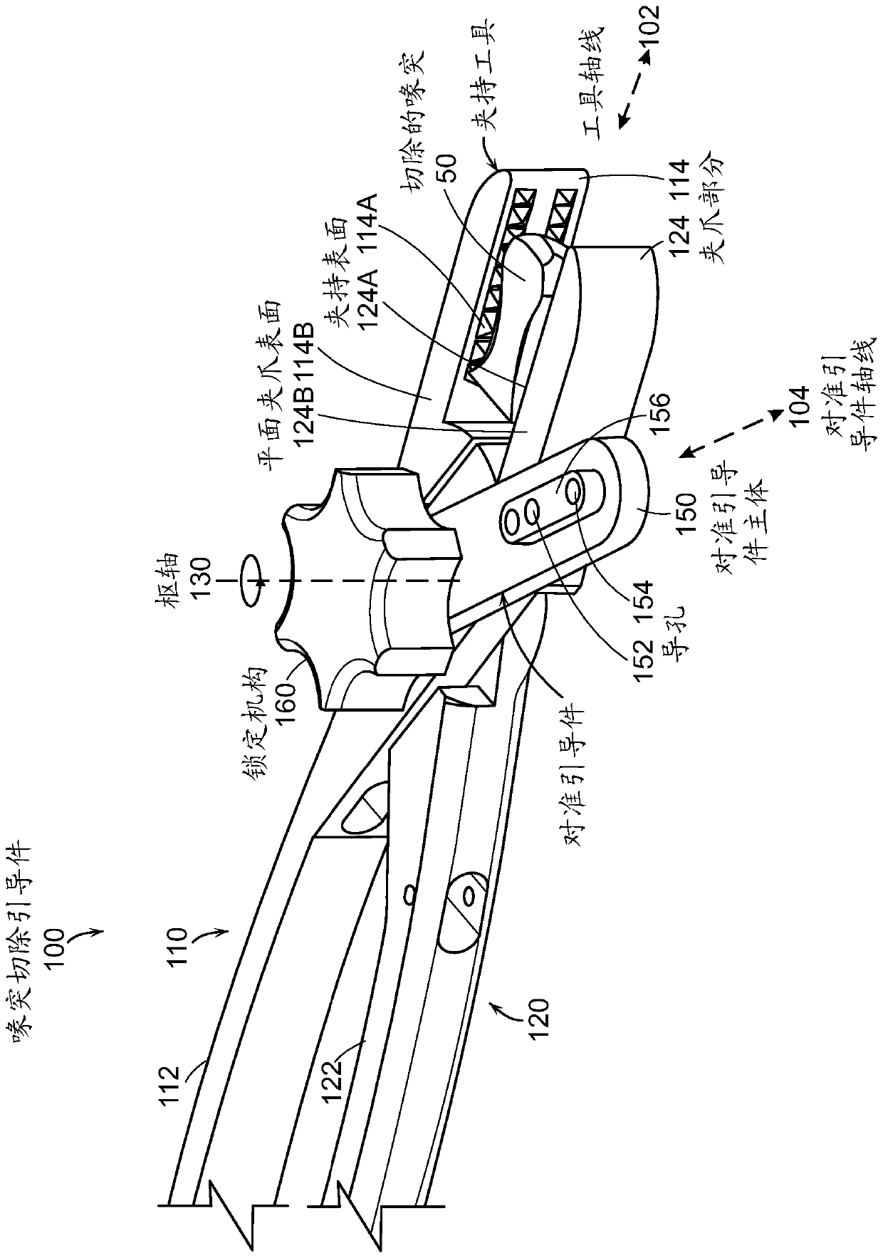 Open LATARJET for correction of anterior-inferior glenoid bone loss