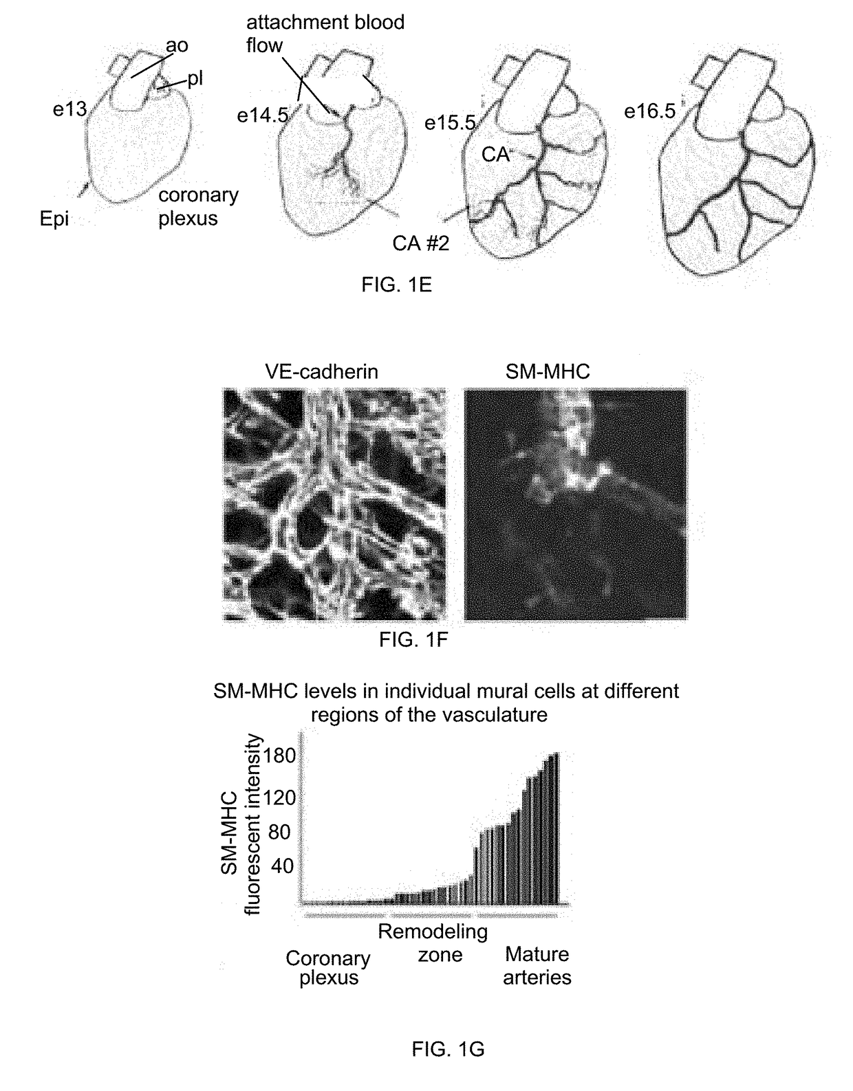 Pericytes are intermediate progenitors for epicardial derived coronary artery smooth muscle