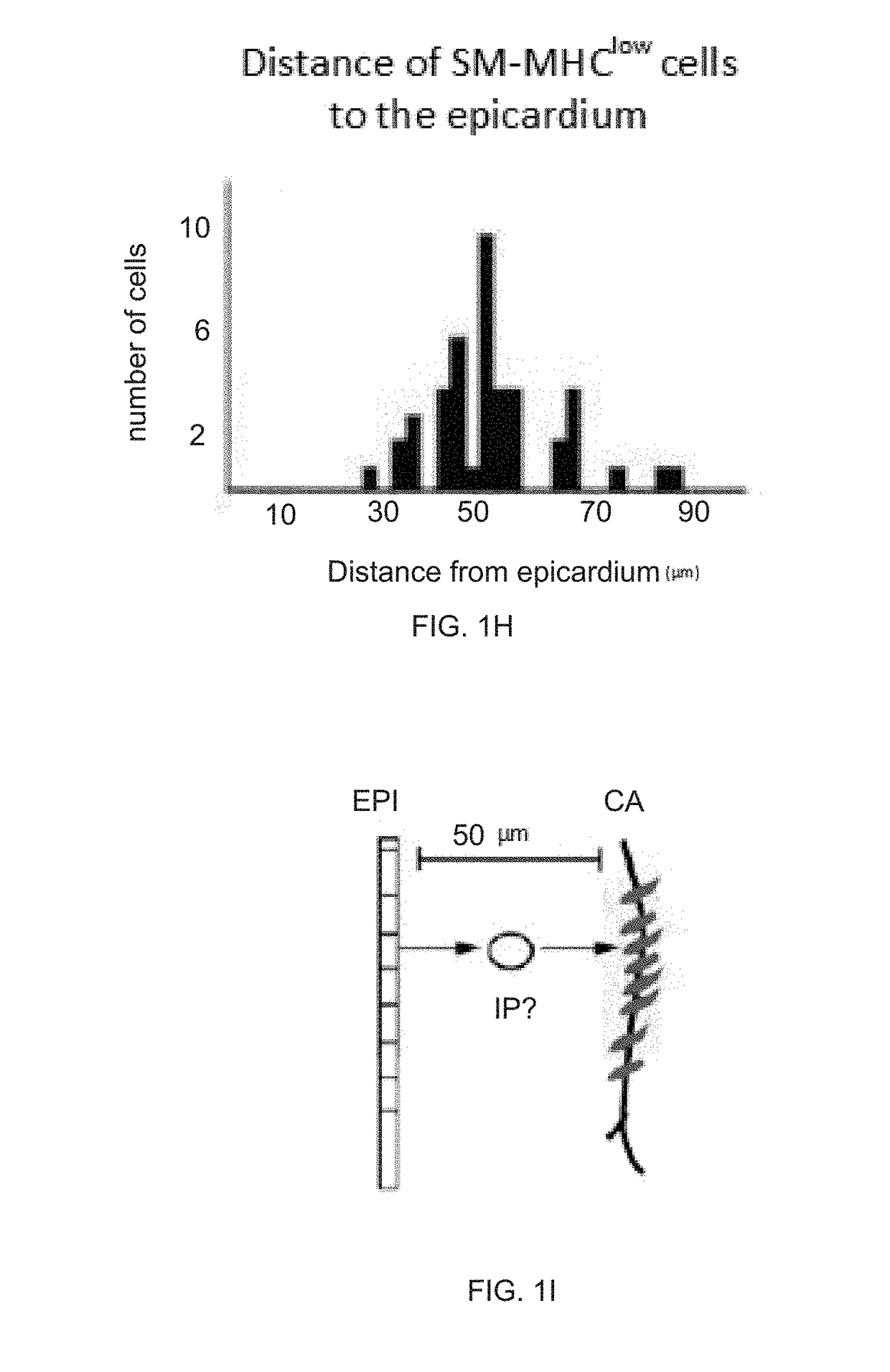 Pericytes are intermediate progenitors for epicardial derived coronary artery smooth muscle