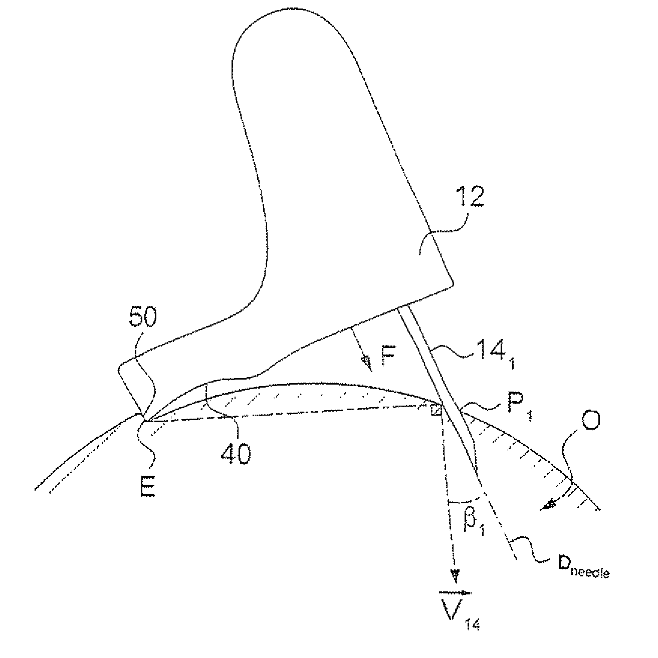 Eye injection device