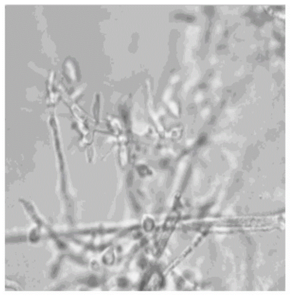 Cellulose degradation fungus in intestinal tract of dragonfly larva and application thereof