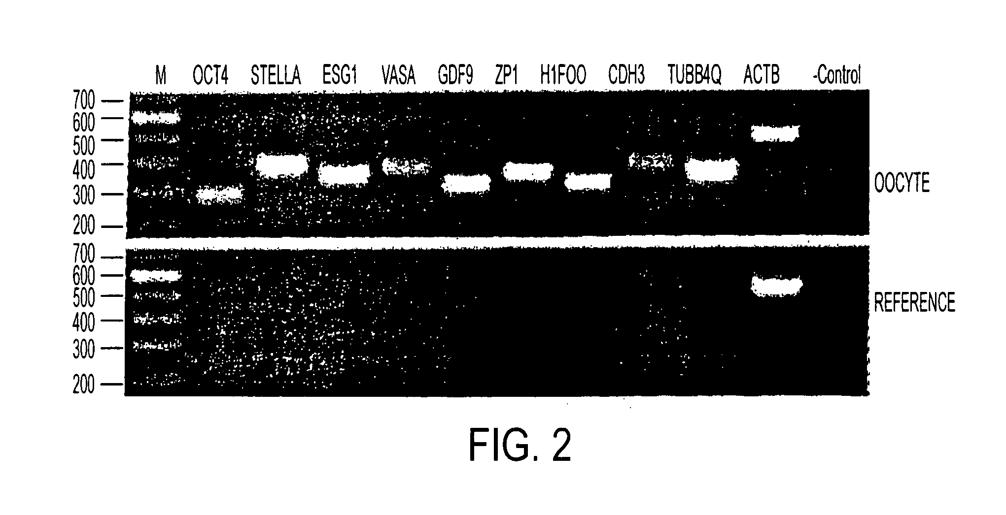 Human transcriptome corresponding to human oocytes and use of said genes or the corresponding polypeptides to trans-differentiate somatic cells