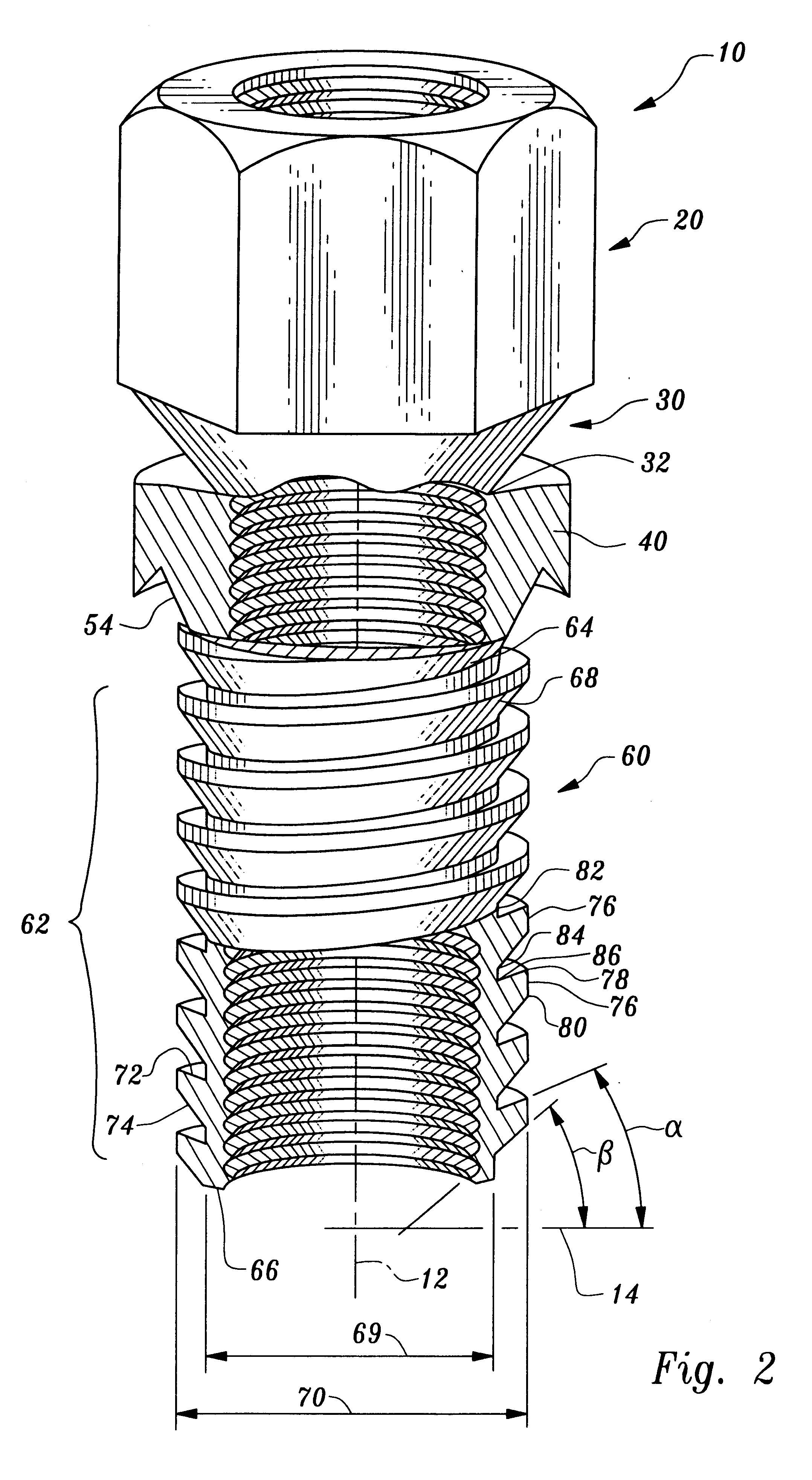 Thread repair insert