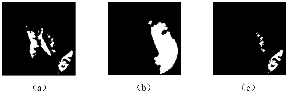 Ischemic penumbra identification method and equipment, electronic device and storage medium