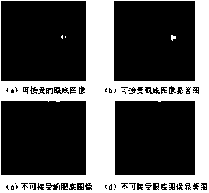 Eye fundus image quality evaluation method based on human vision system