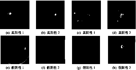 Eye fundus image quality evaluation method based on human vision system