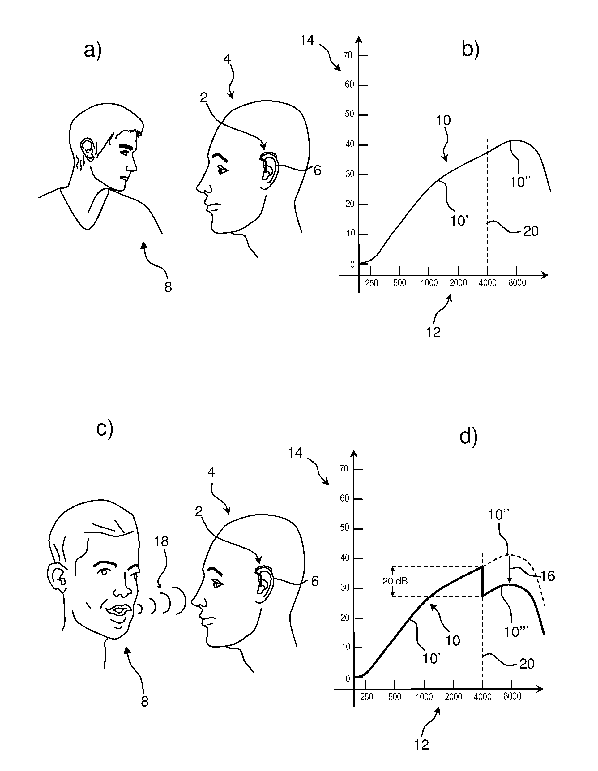 Hearing aid specialized as a supplement to lip reading