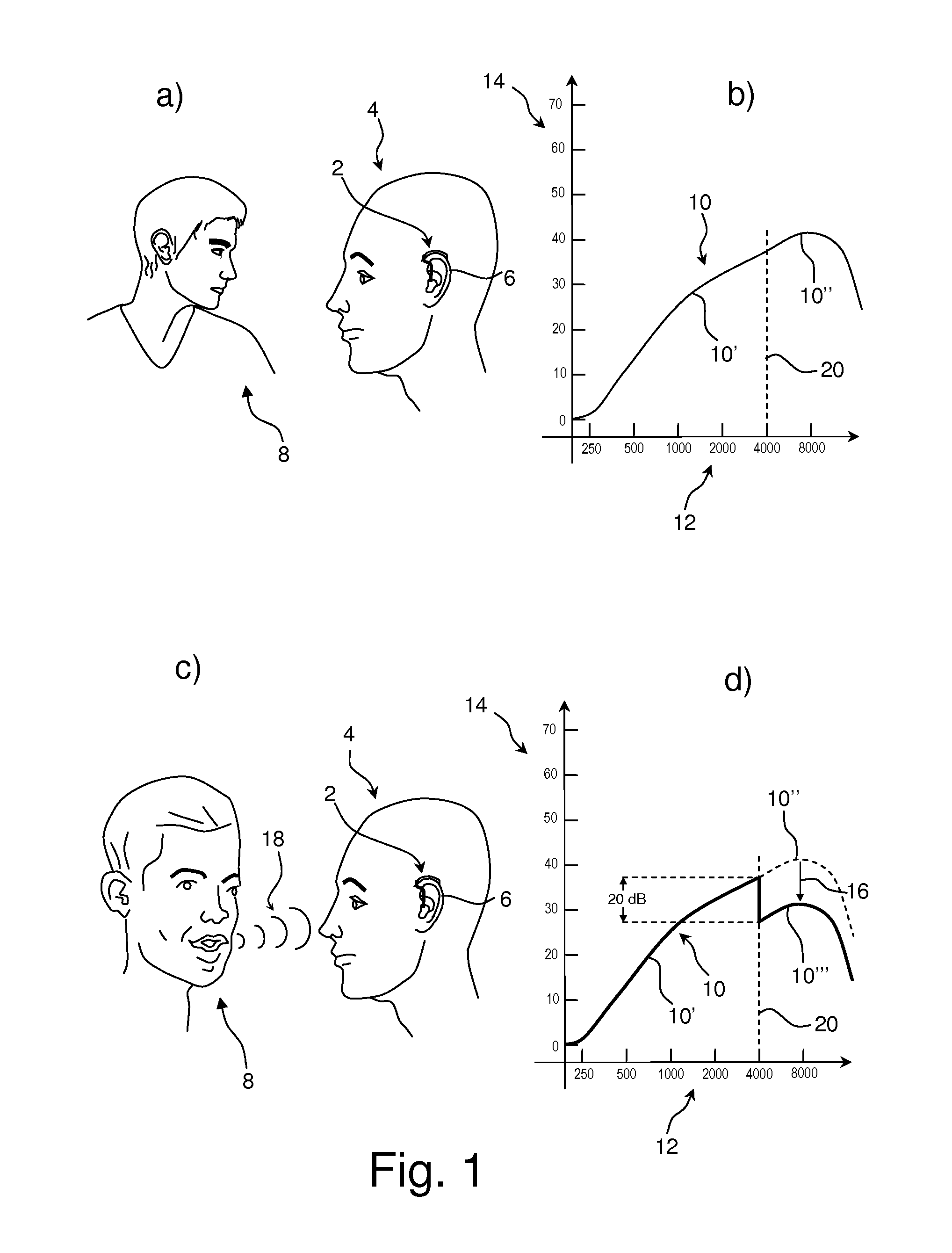 Hearing aid specialized as a supplement to lip reading