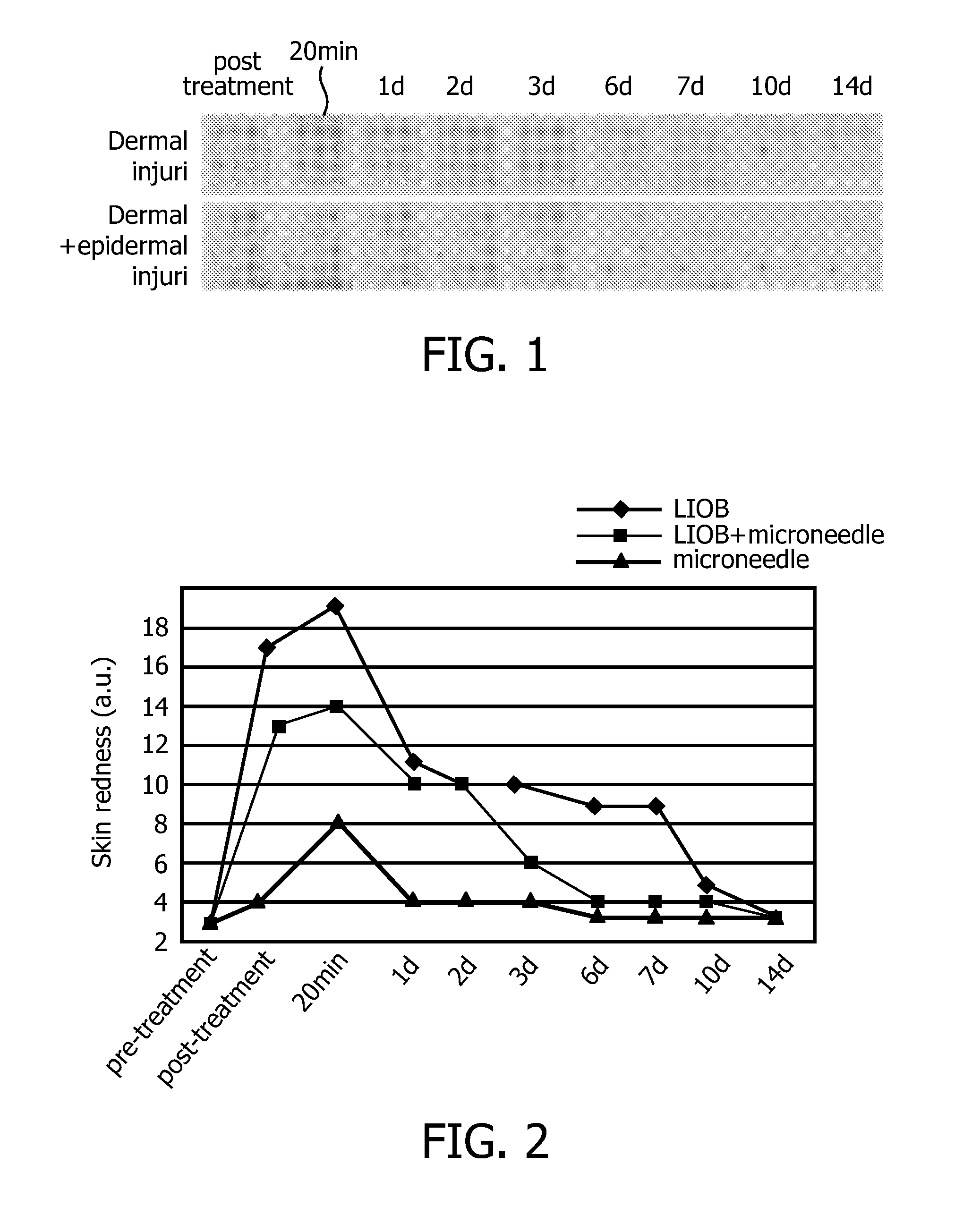 Skin treatment method and apparatus