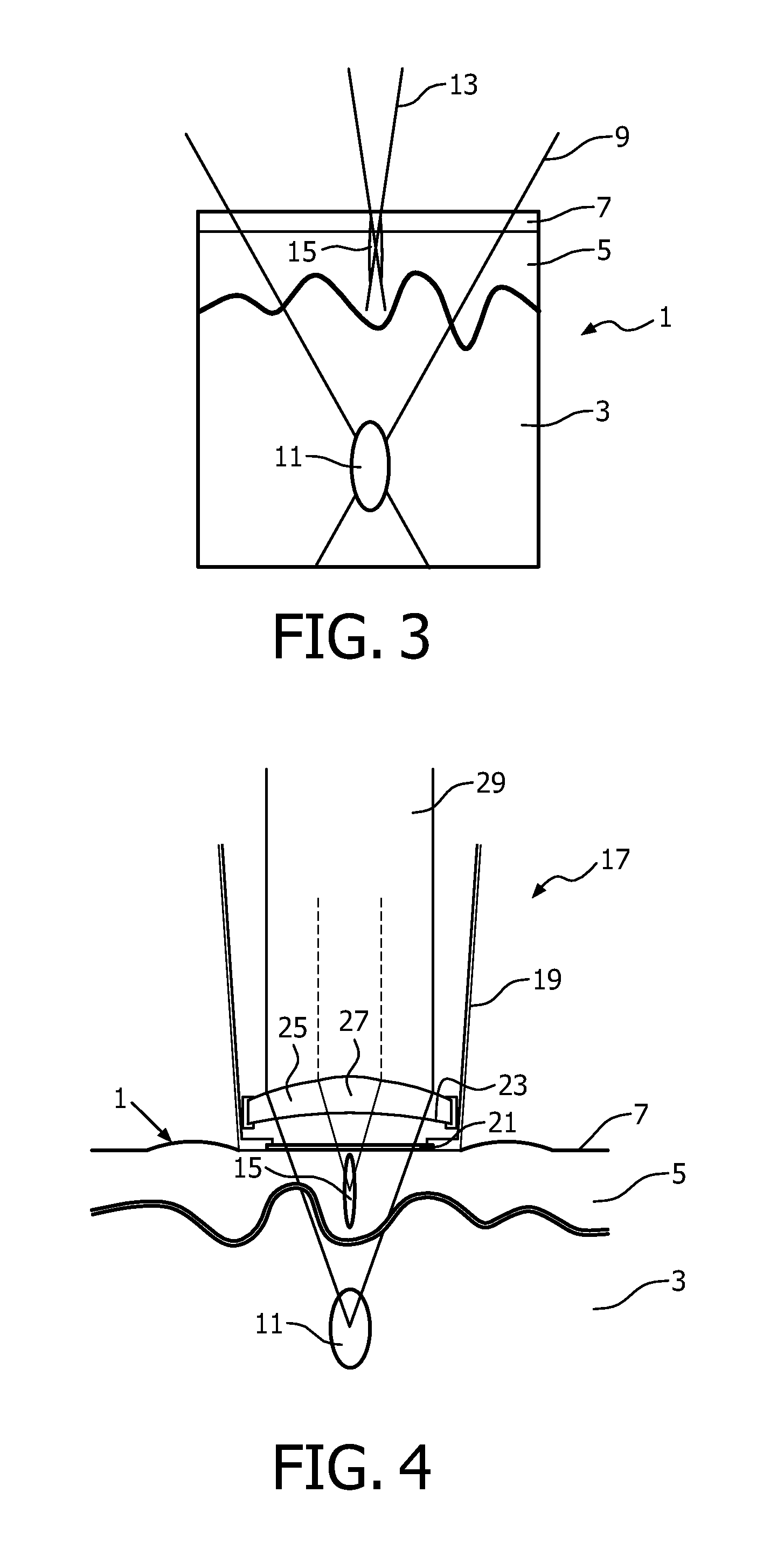 Skin treatment method and apparatus