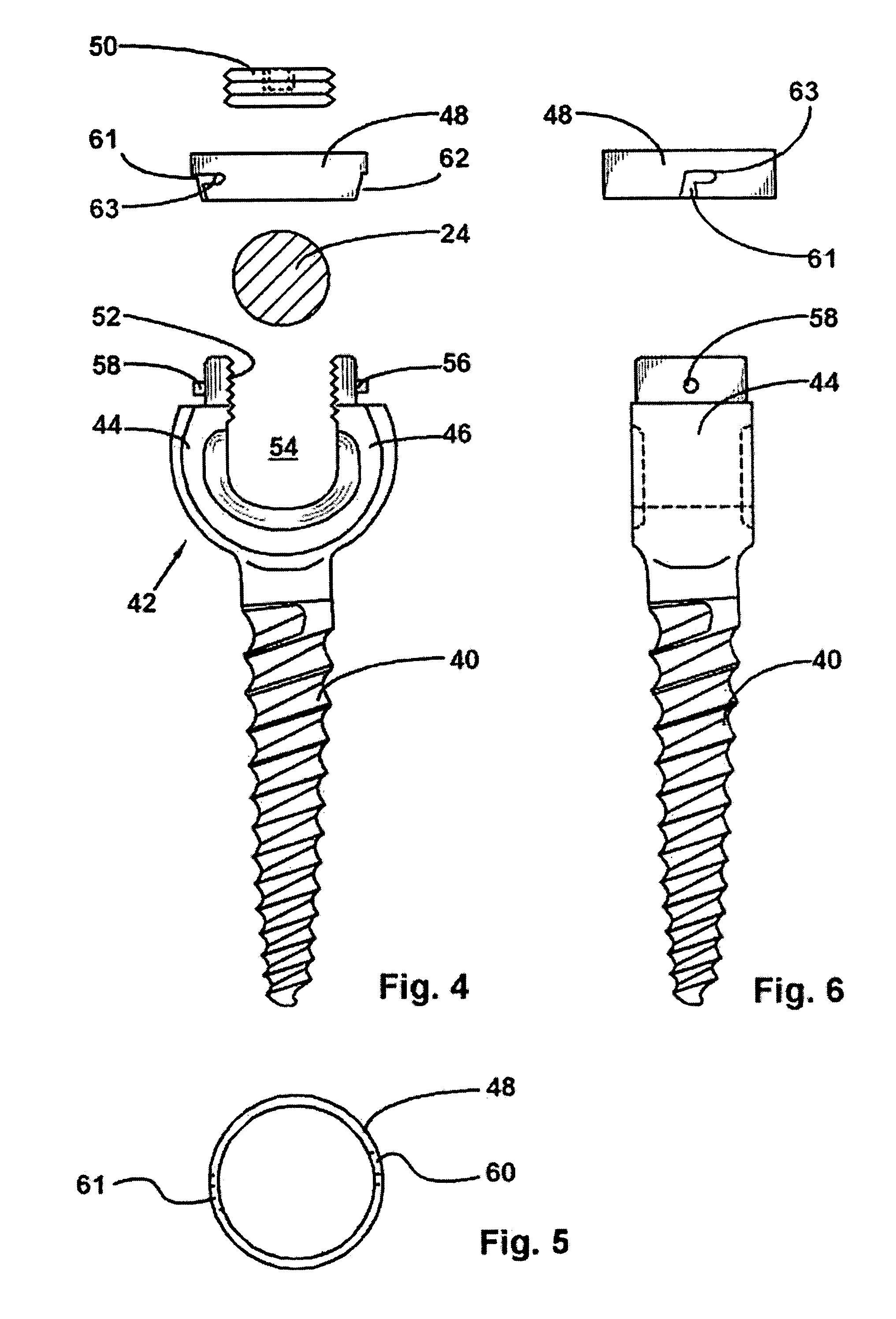 Anchoring element for securing a rod on a vertebra