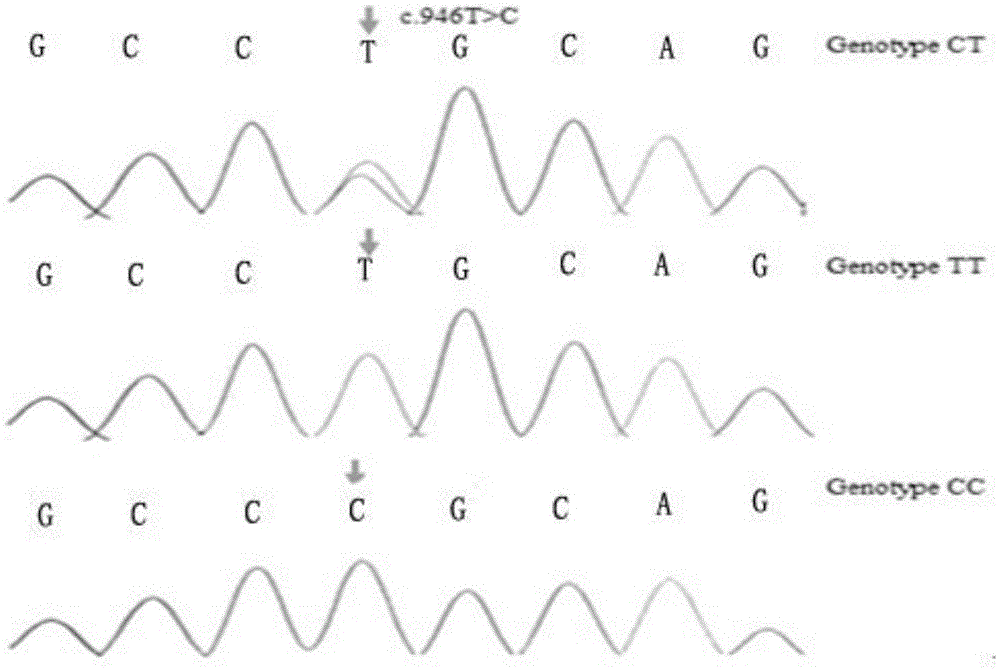 Meat-duck OTXR gene single nucleotide polymorphism and detecting method and application thereof