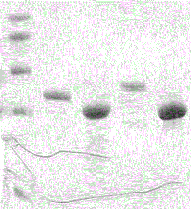 Mumps virus HN antigen and application of antigen in detection of mumps-resisting virus antibody