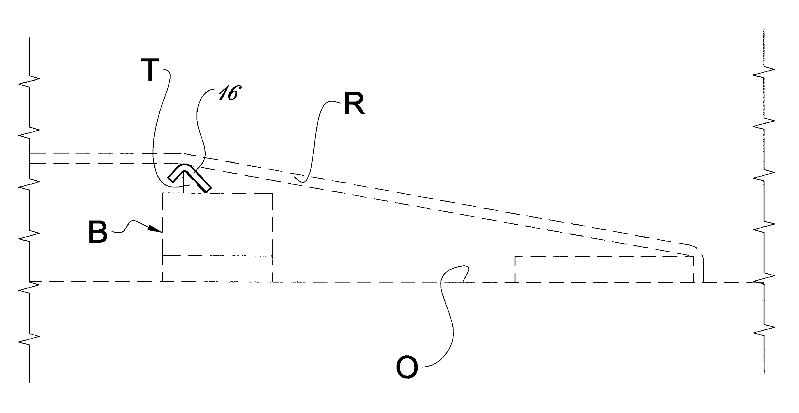 String instrument suspension system