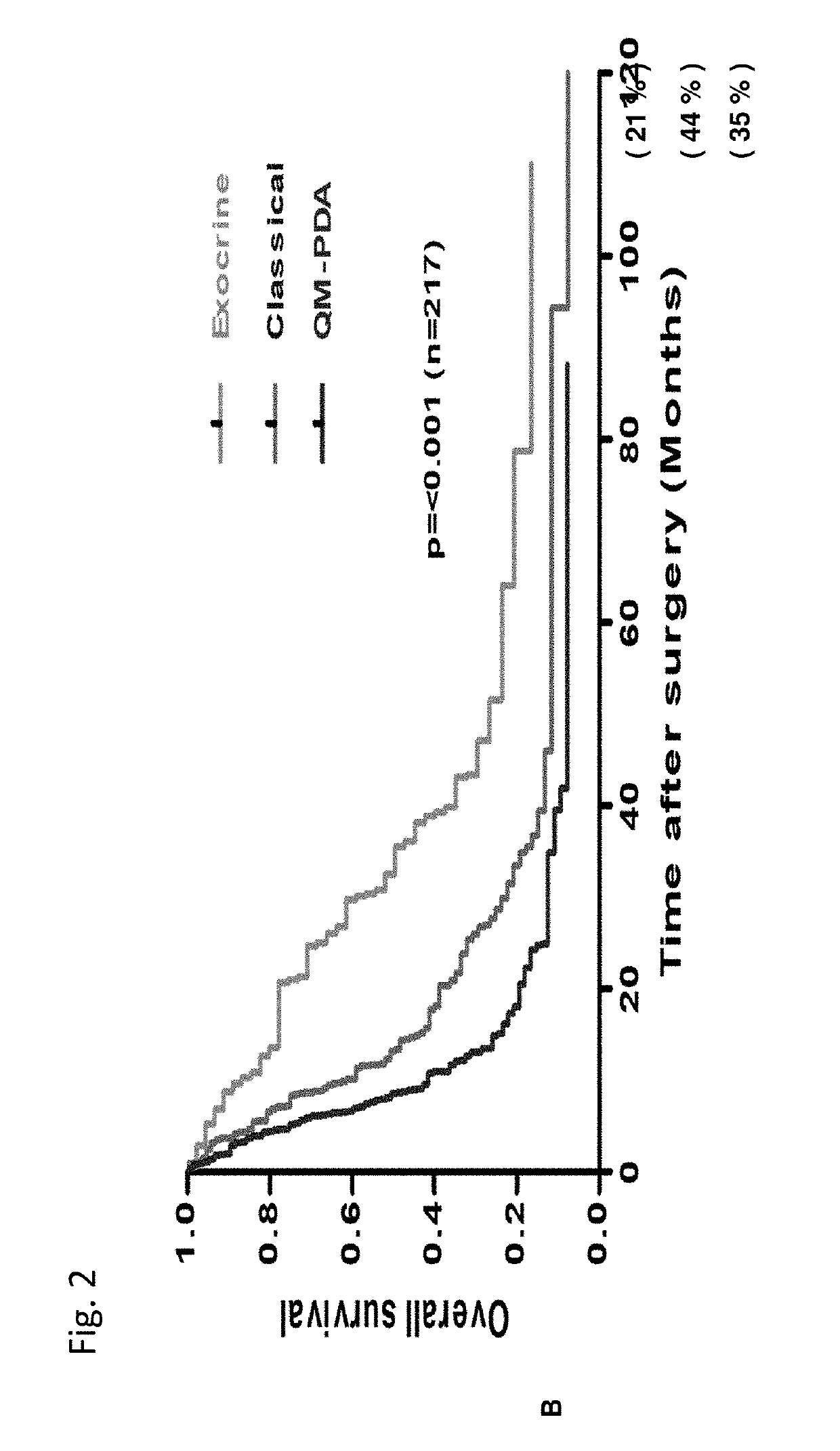 Novel Biomarkers for Sub-Typing Pancreatic Ductal Adenocarcinoma