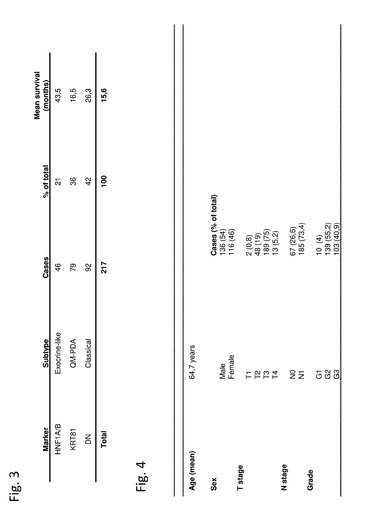 Novel Biomarkers for Sub-Typing Pancreatic Ductal Adenocarcinoma