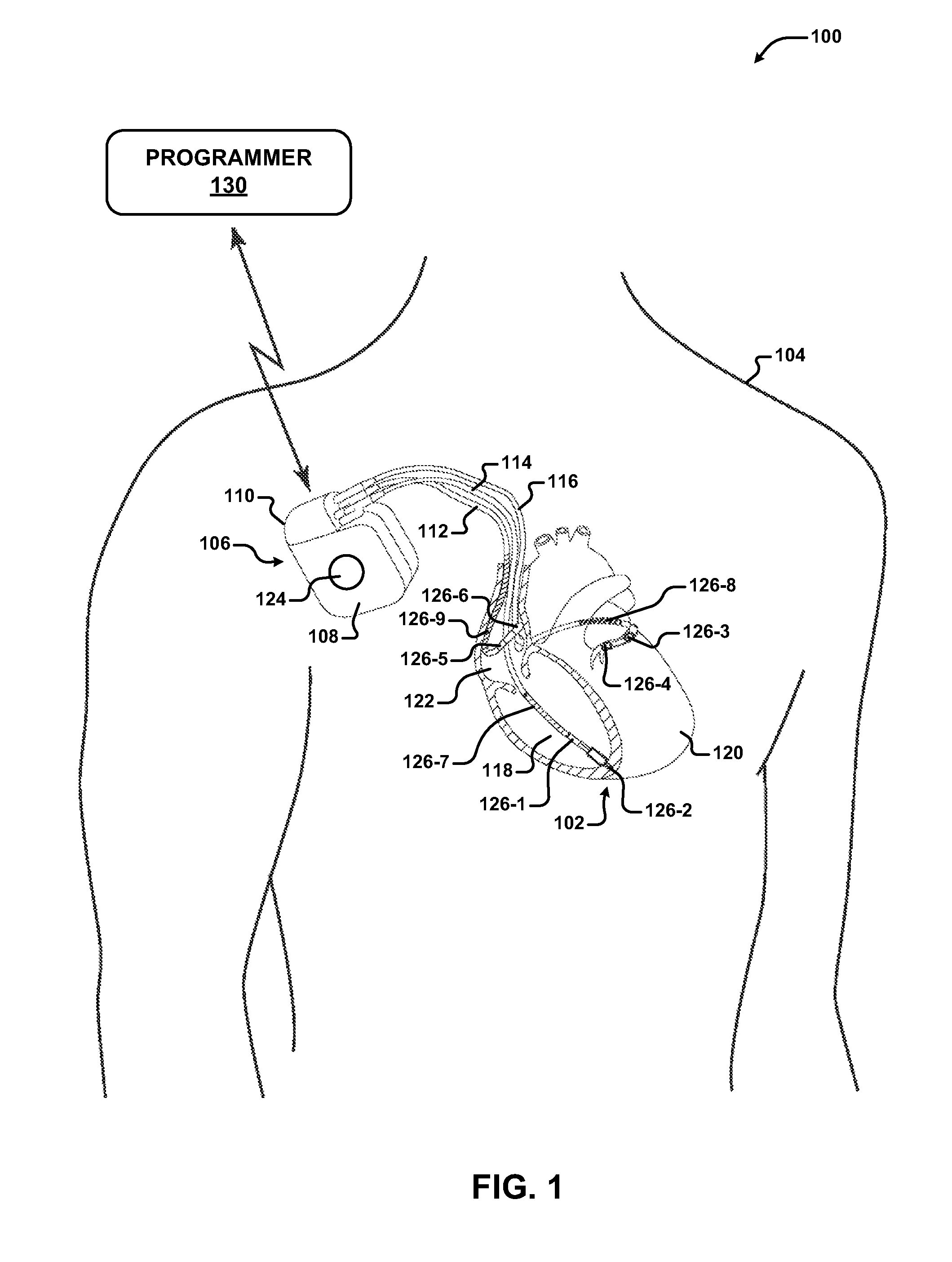 Techniques for modifying breathing rate using cardiac pacing