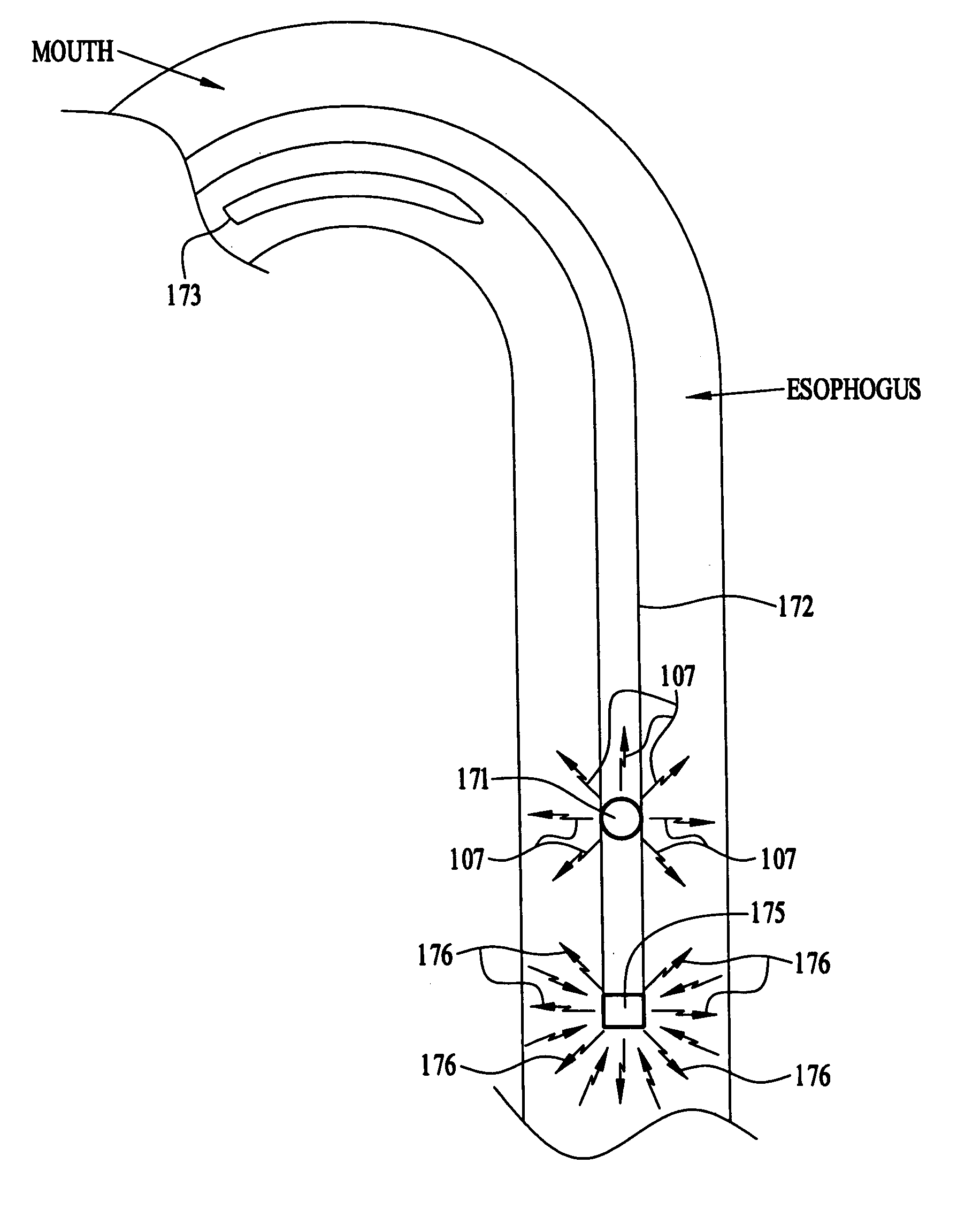 Device and system for improved imaging in nuclear medicine