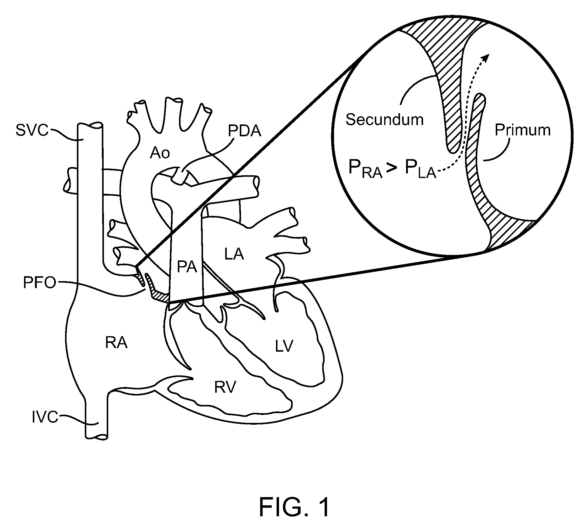 Multi-electrode apparatus for tissue welding and ablation