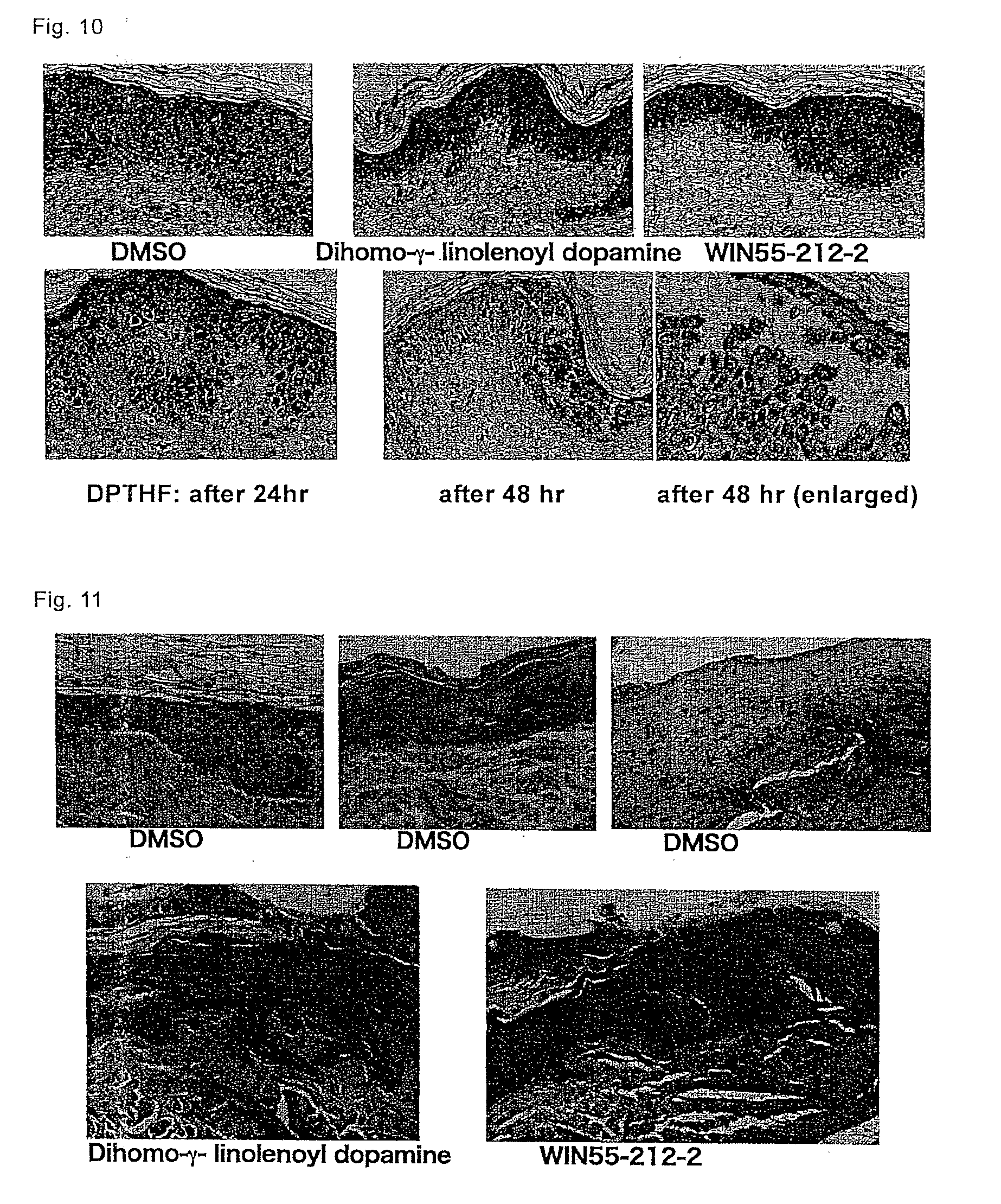 Medicament for prophylactic and therapeutic treatment of dermatosis resulting from excessively advanced keratinization