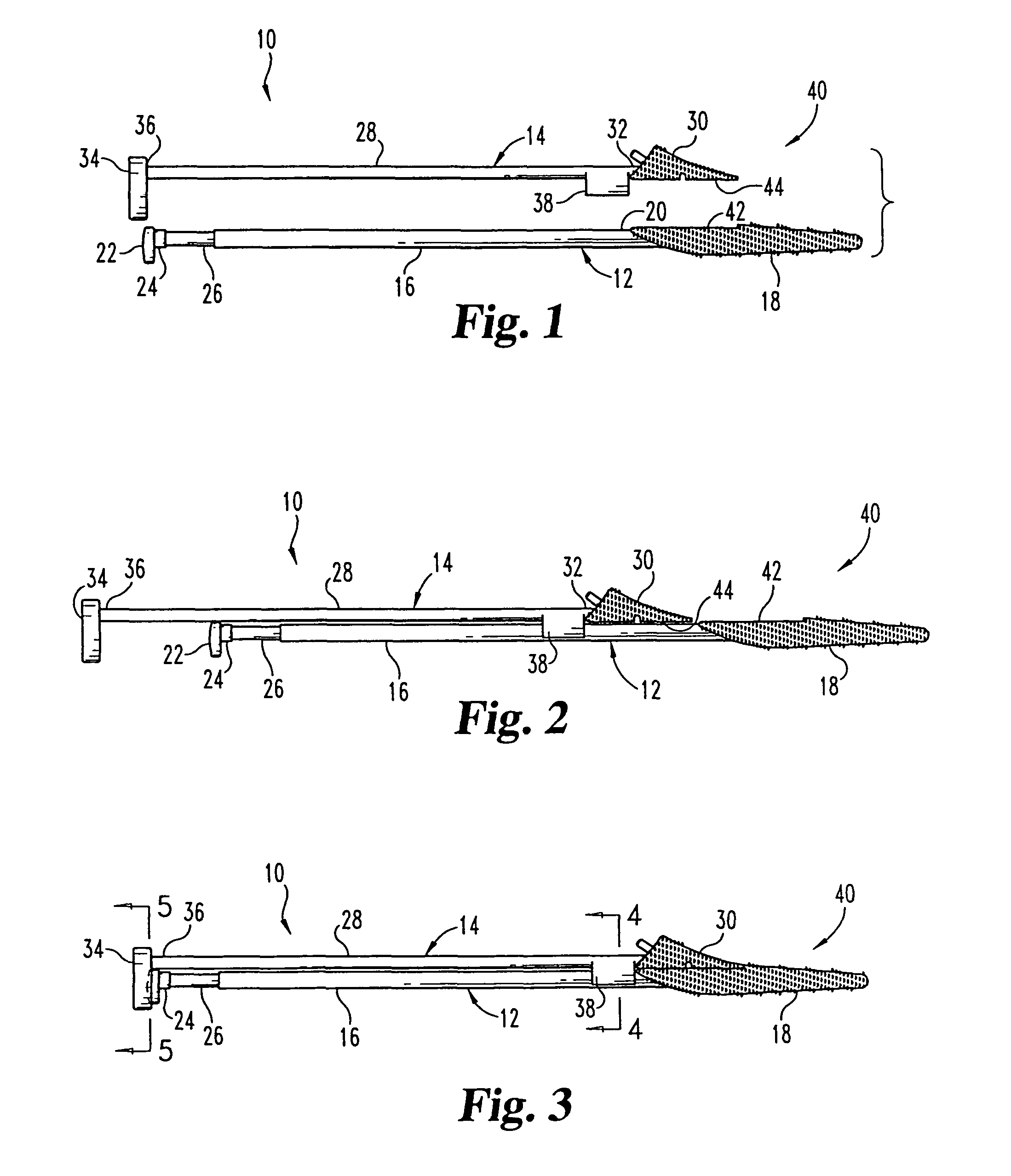 Method and instrumentation for performing minimally invasive hip arthroplasty