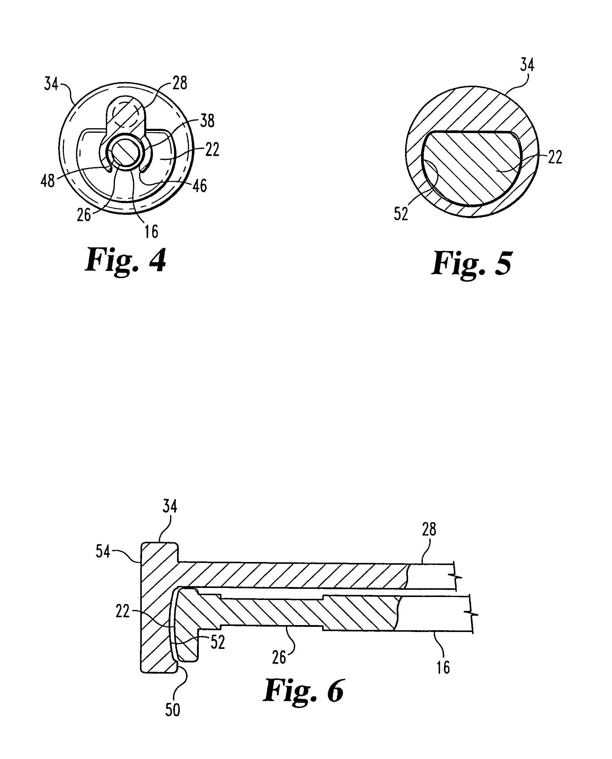 Method and instrumentation for performing minimally invasive hip arthroplasty