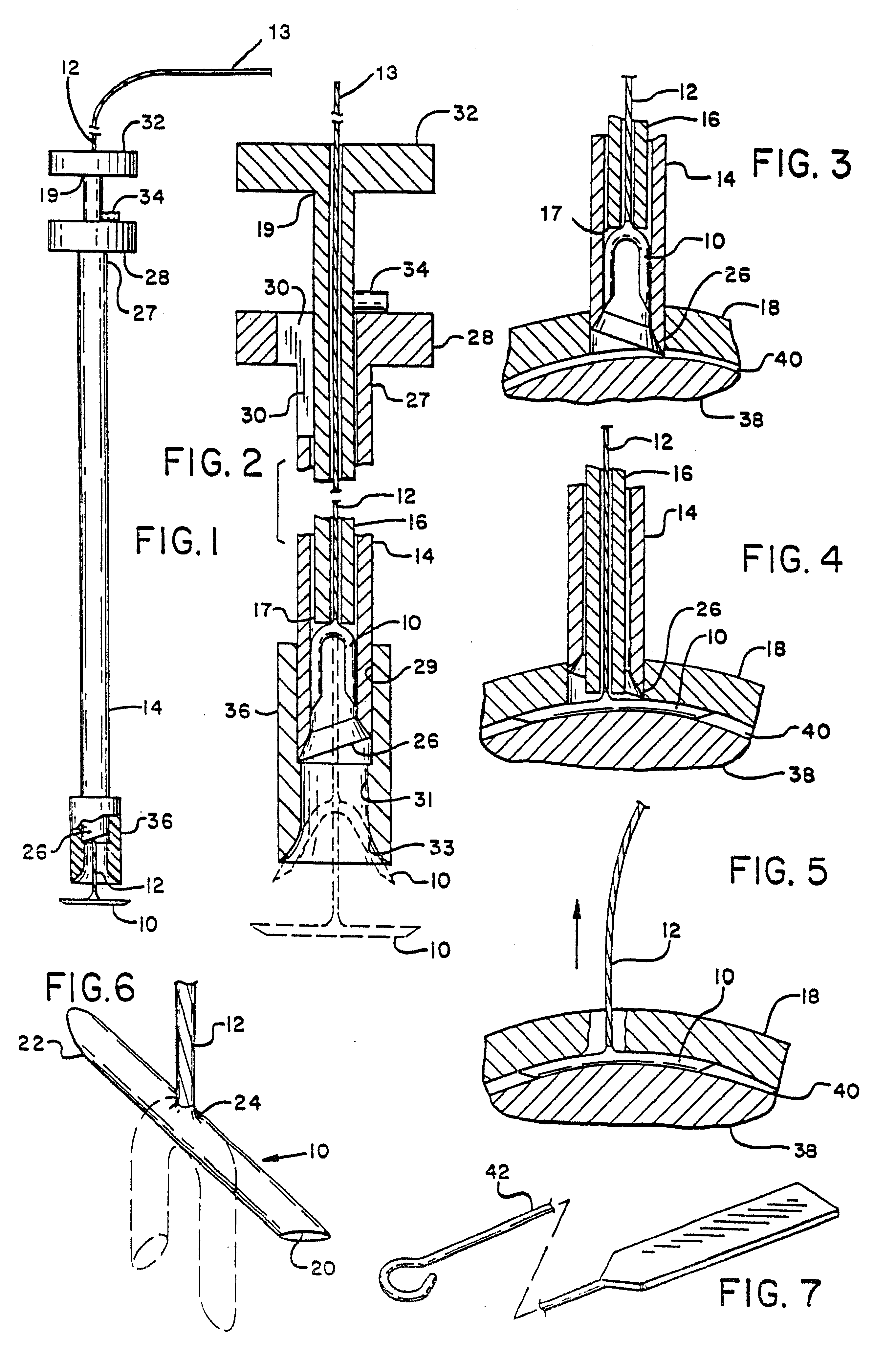 Tissue manipulation