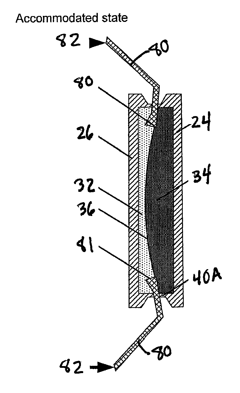 Interfacial refraction accommodating lens (IRAL)