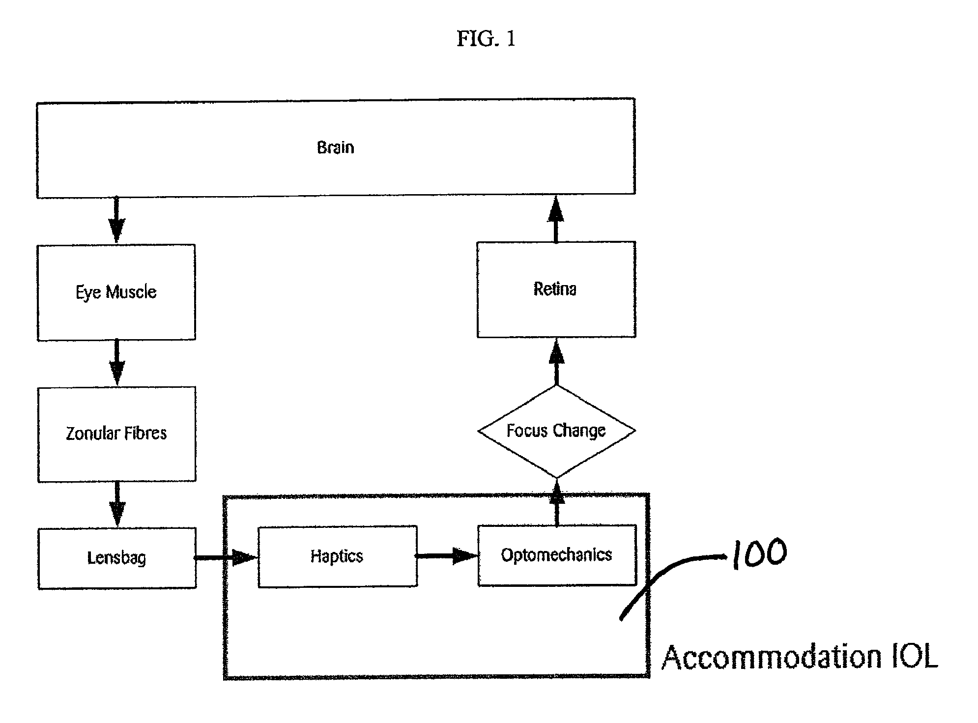 Interfacial refraction accommodating lens (IRAL)