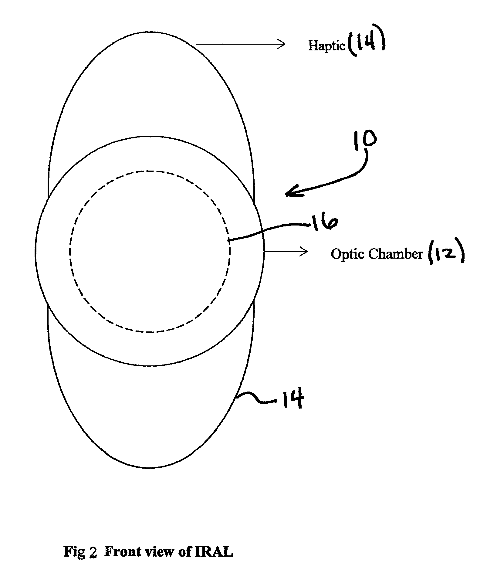 Interfacial refraction accommodating lens (IRAL)