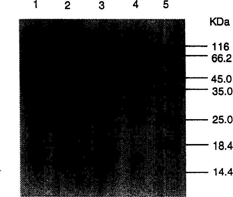 Immunological adjuvant with immunity vegulating agent for treating and preventing diabetic from insulin-dependent