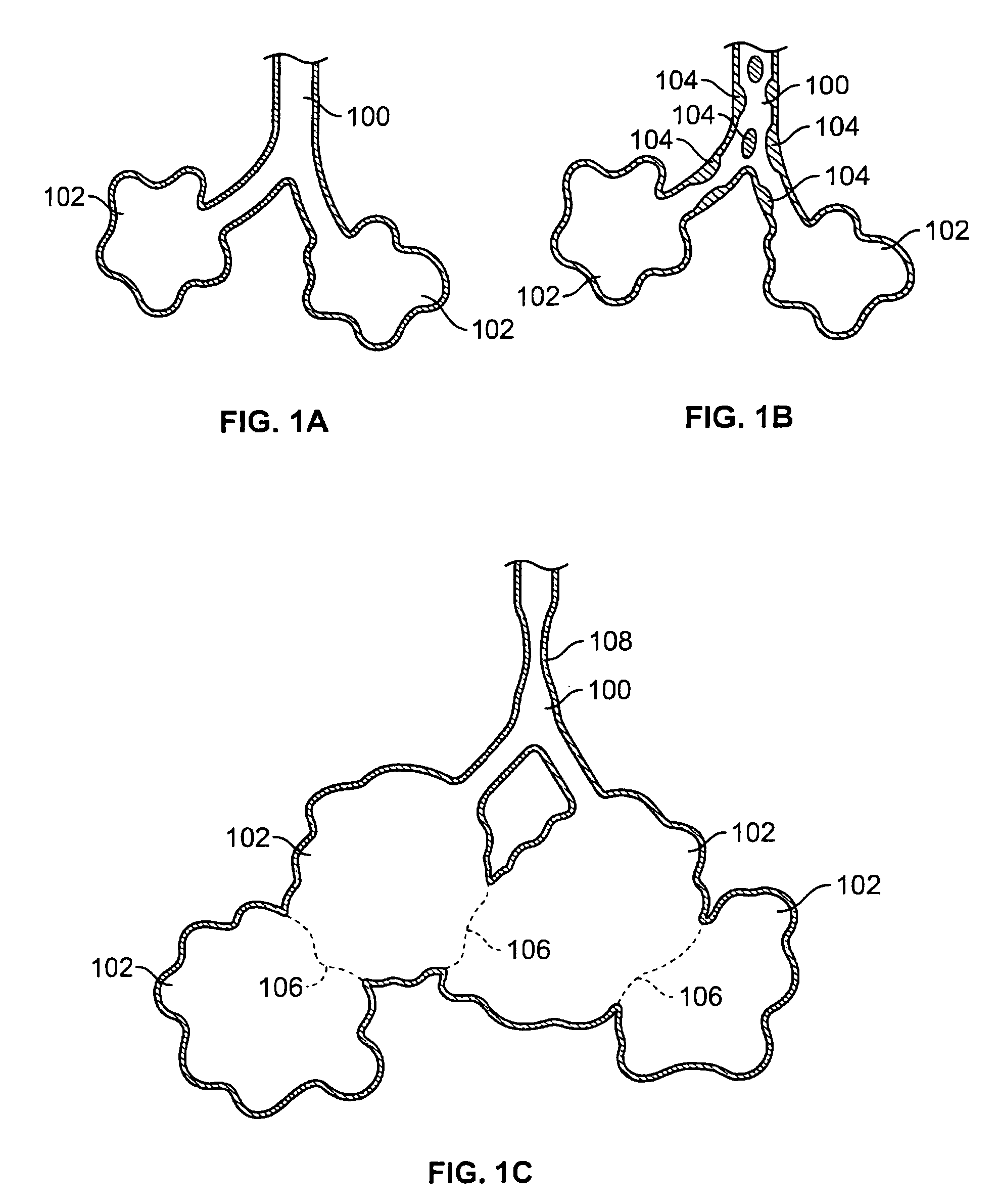 Devices for maintaining patency of surgically created channels in tissue