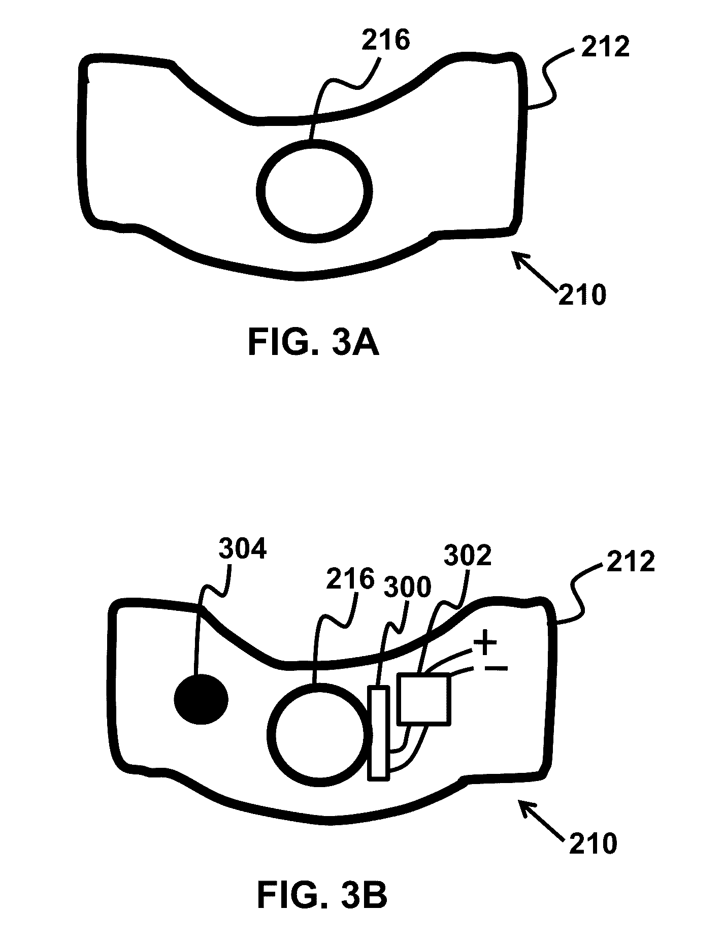 Device and method for correcting obstructive sleep apnea