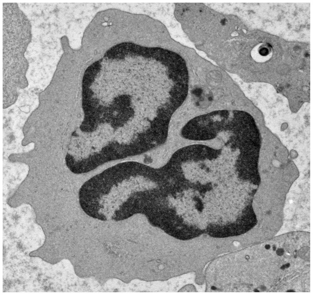 A method for isolating and culturing alveolar type II epithelial cells of naked mole rats