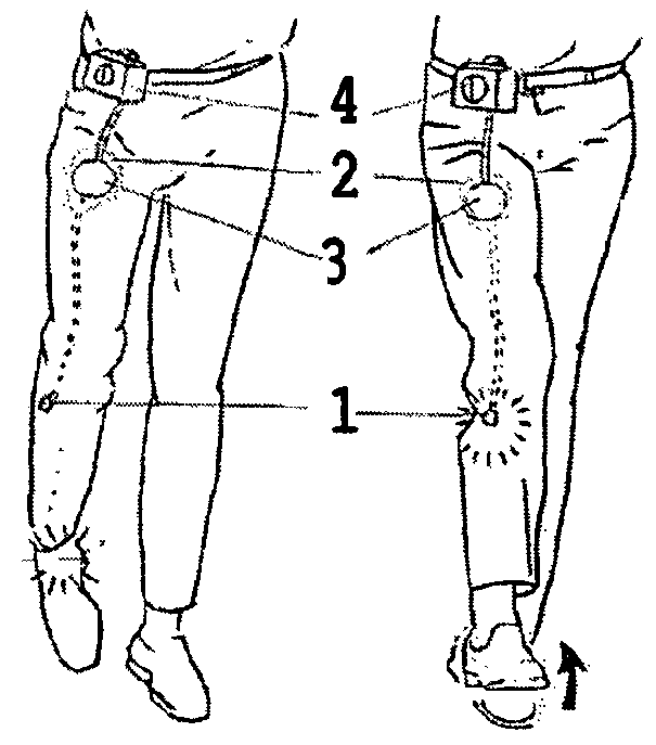 System for electrical stimulation of nerves