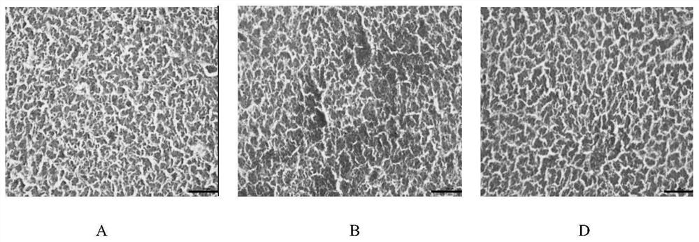 Aflatoxin detoxification composition as well as preparation method and application thereof