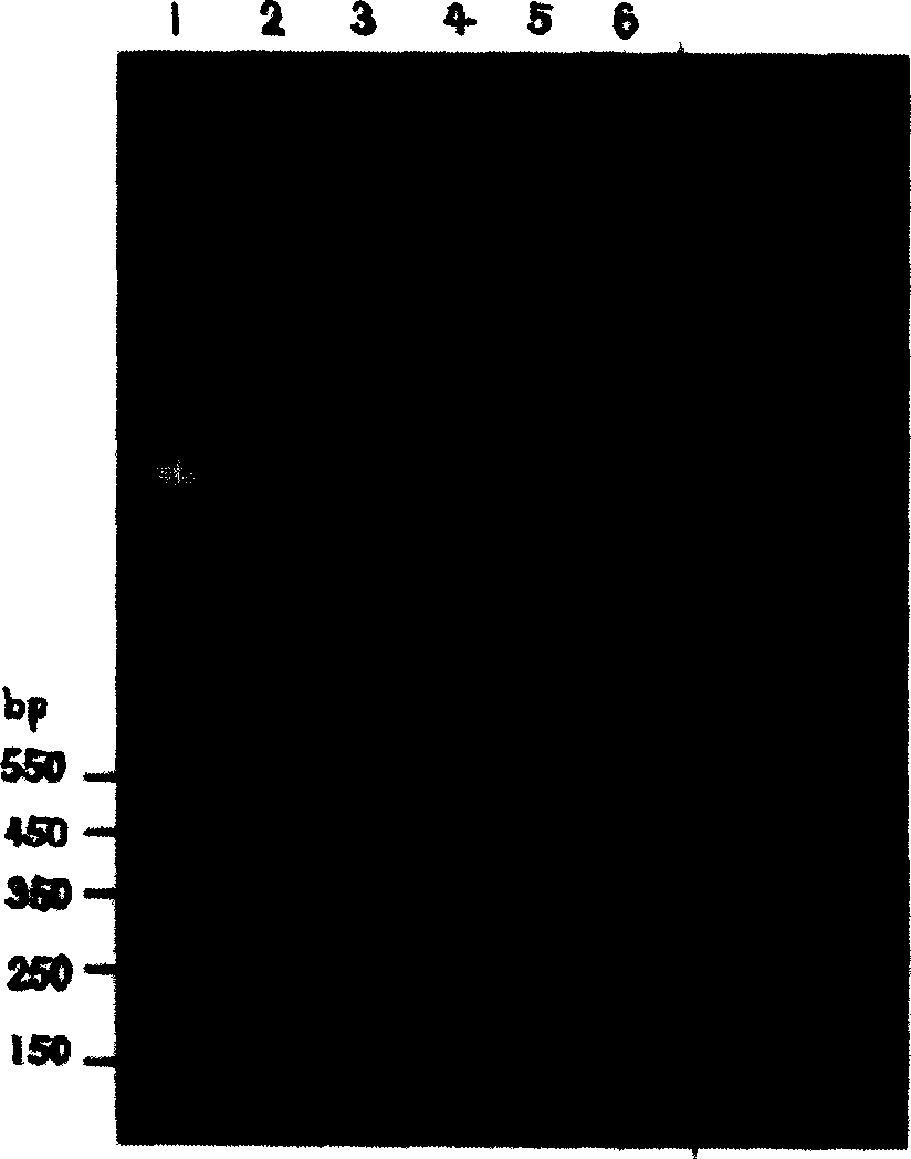 Application of beta sodium aescine in preparation of medicine for treating leukemia