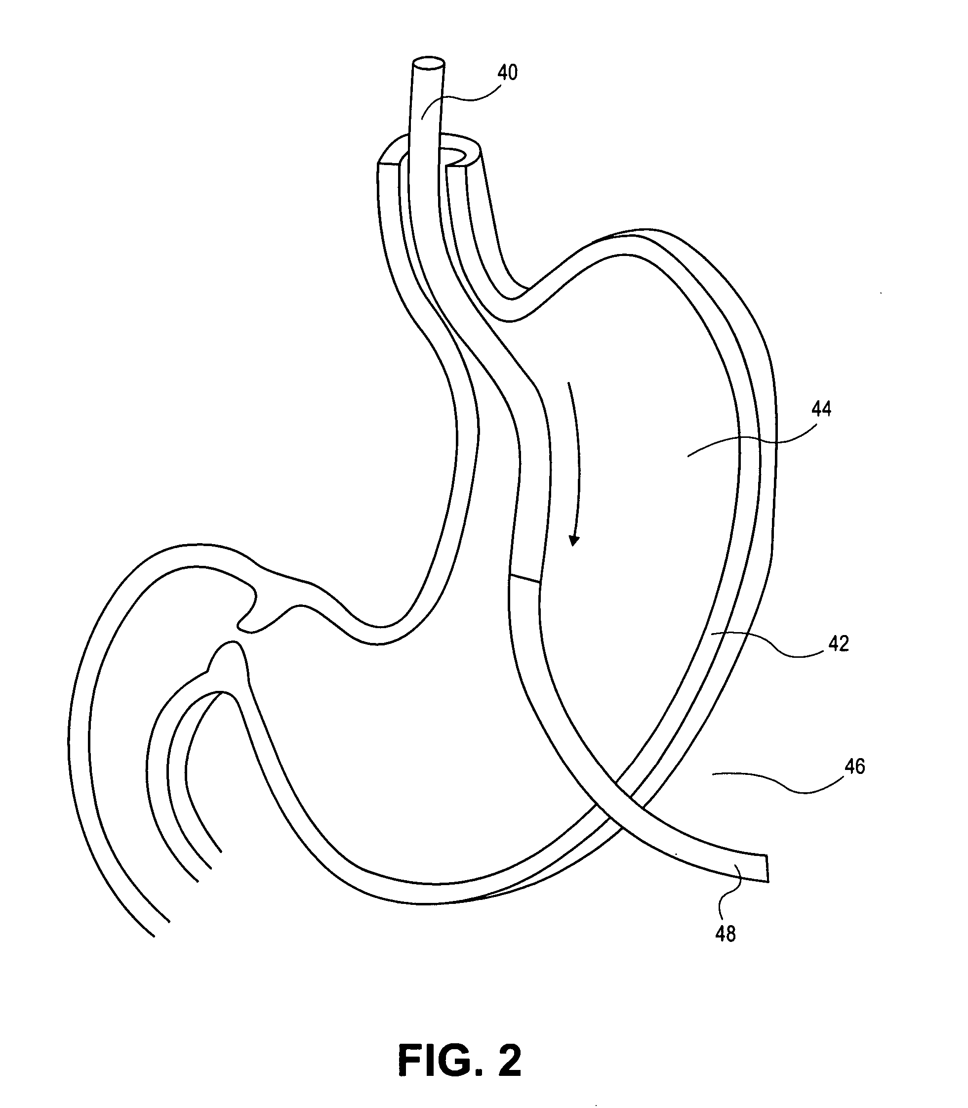 Transvisceral neurostimulation mapping device and method