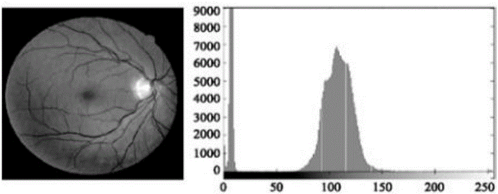 Method for screening ocular fundus images