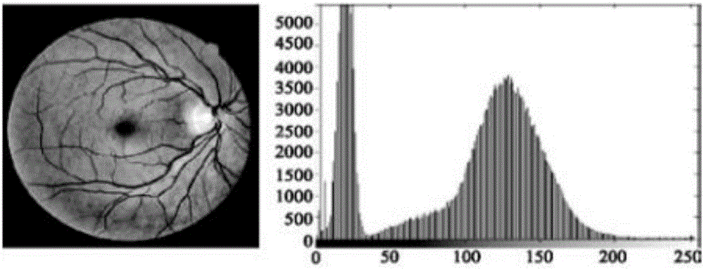 Method for screening ocular fundus images