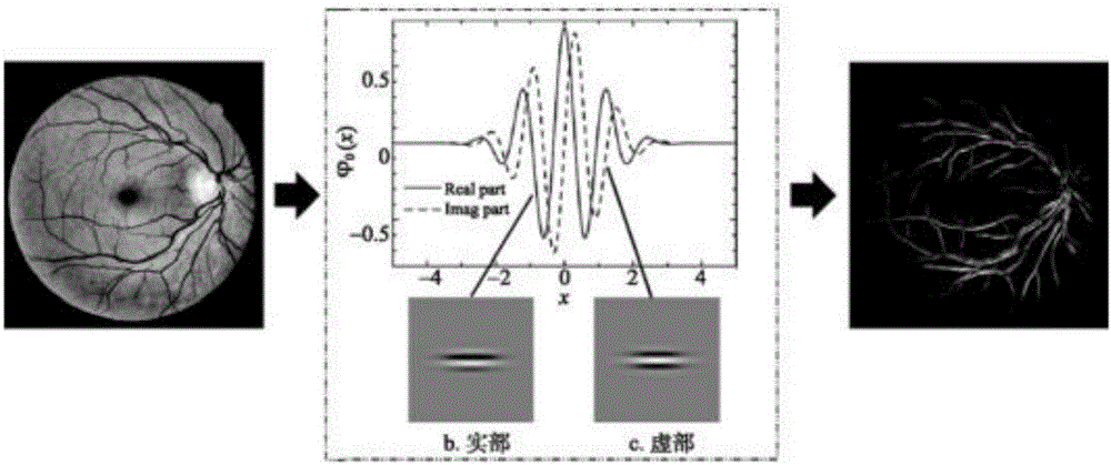 Method for screening ocular fundus images