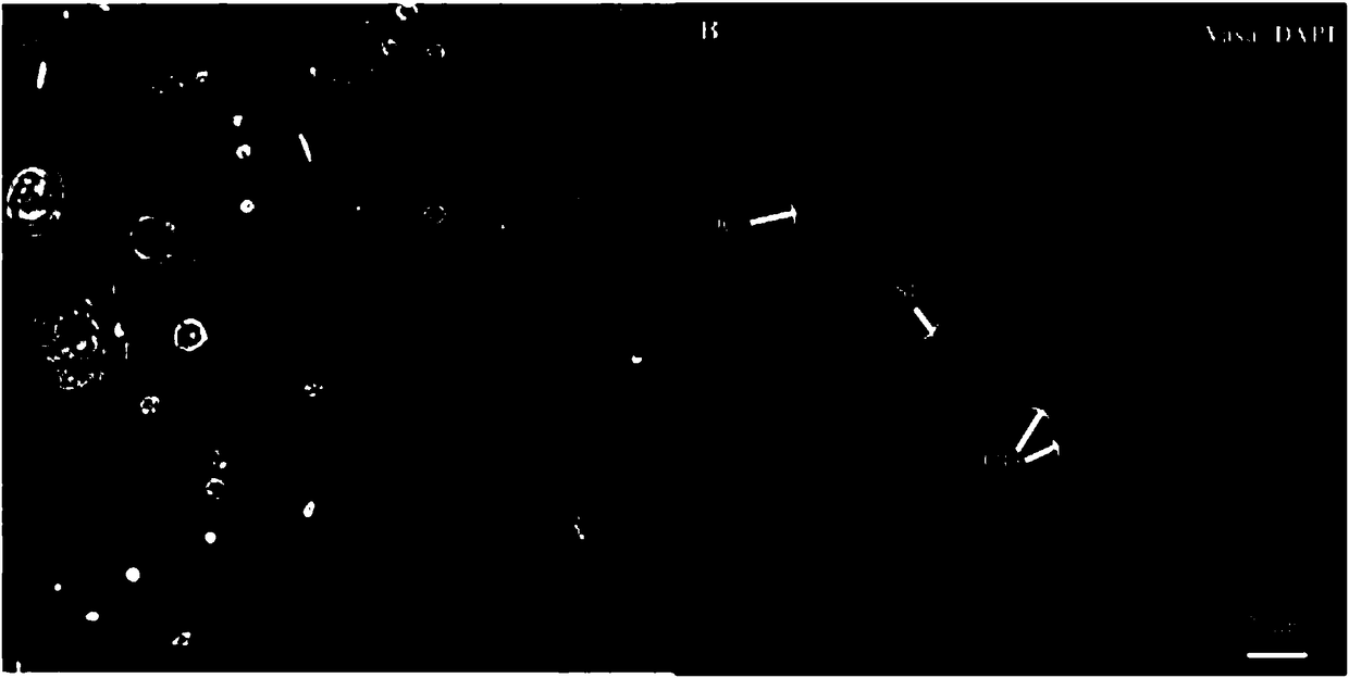 Method for separating and purifying oogonia of paralichthys olivaceus