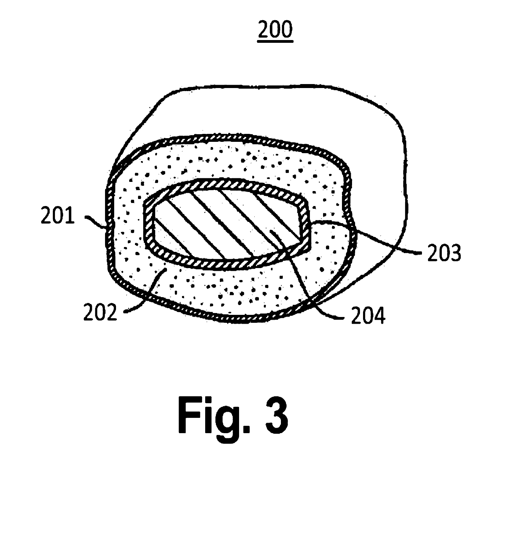 Combination tablet with chewable outer layer