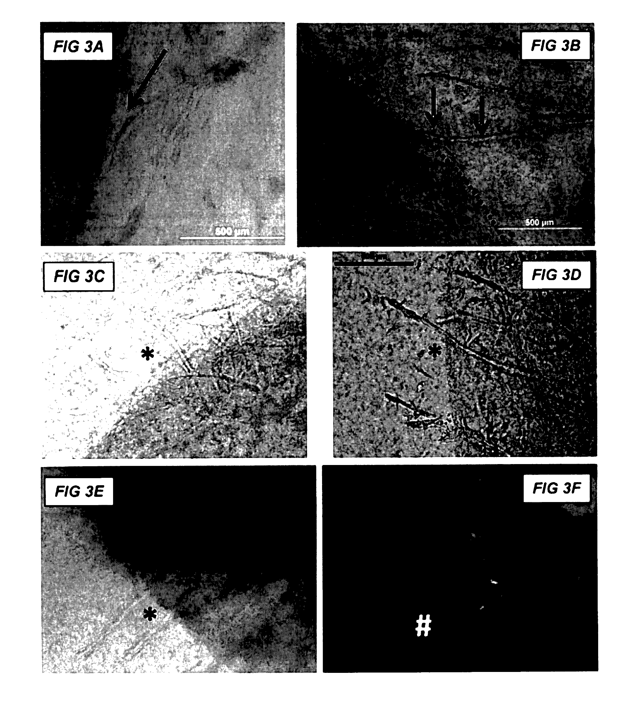 Methods and compositions to support transplanted tissue integration and innosculation with adipose stromal cells