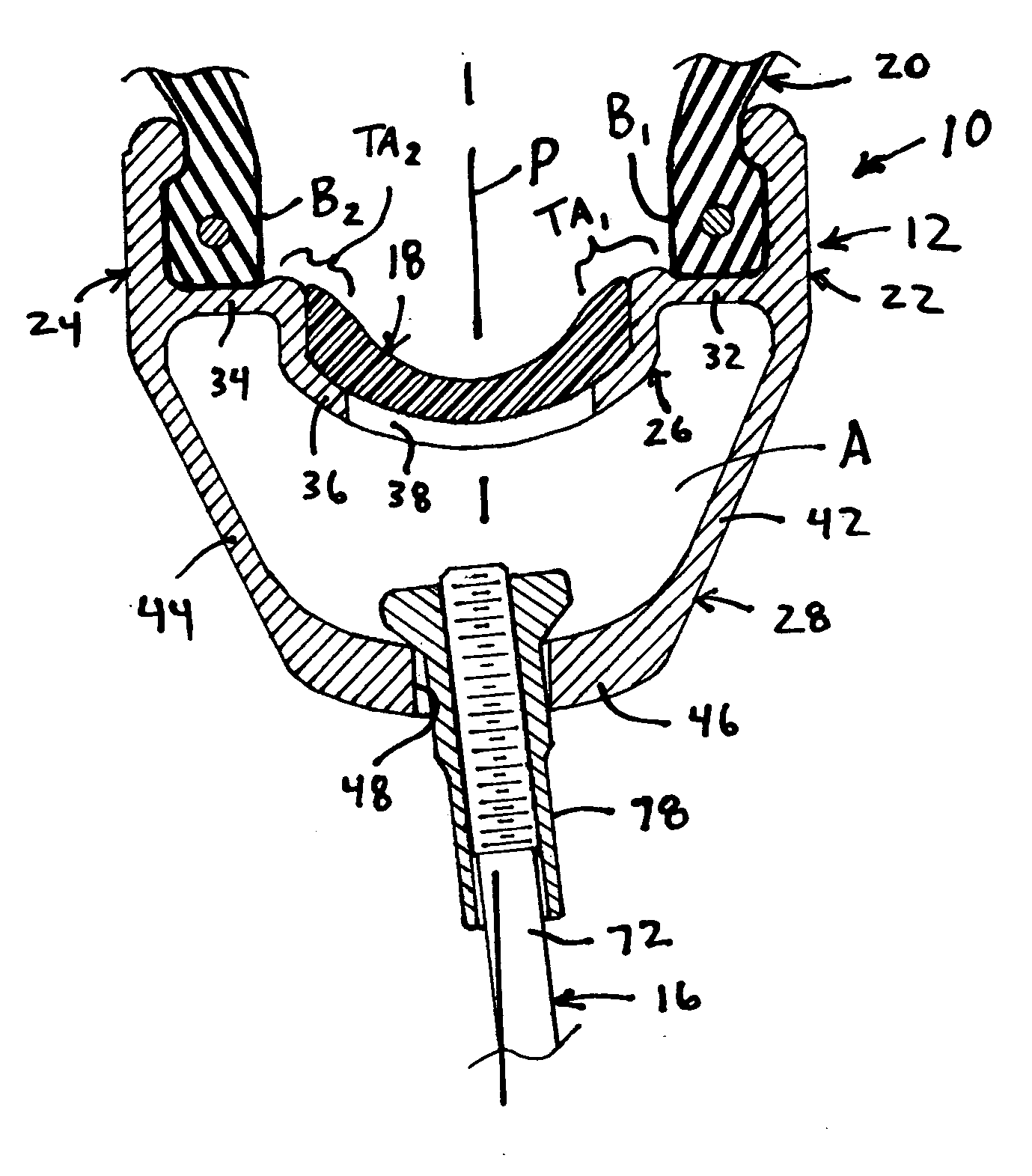 Bicycle rim