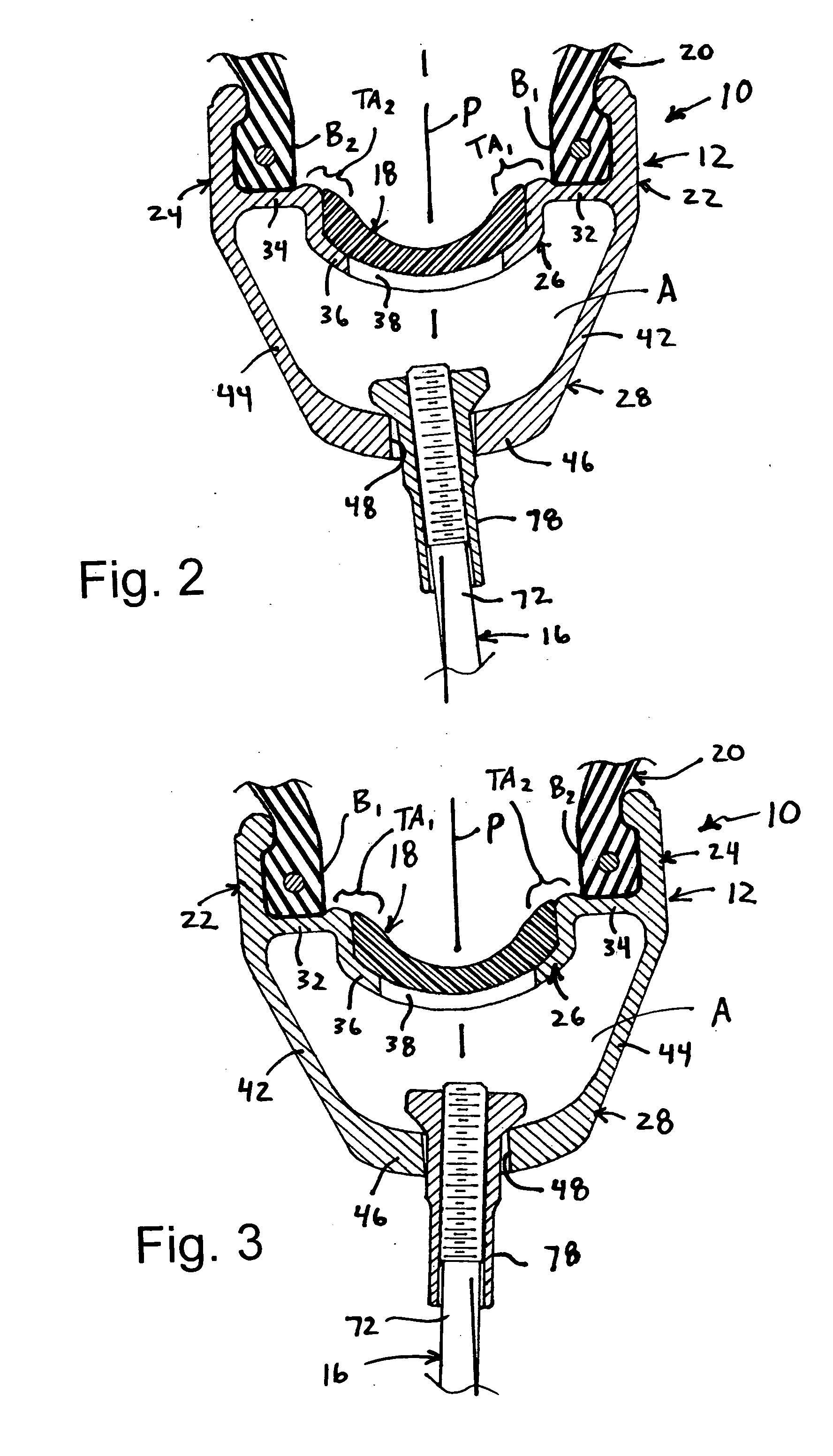 Bicycle rim