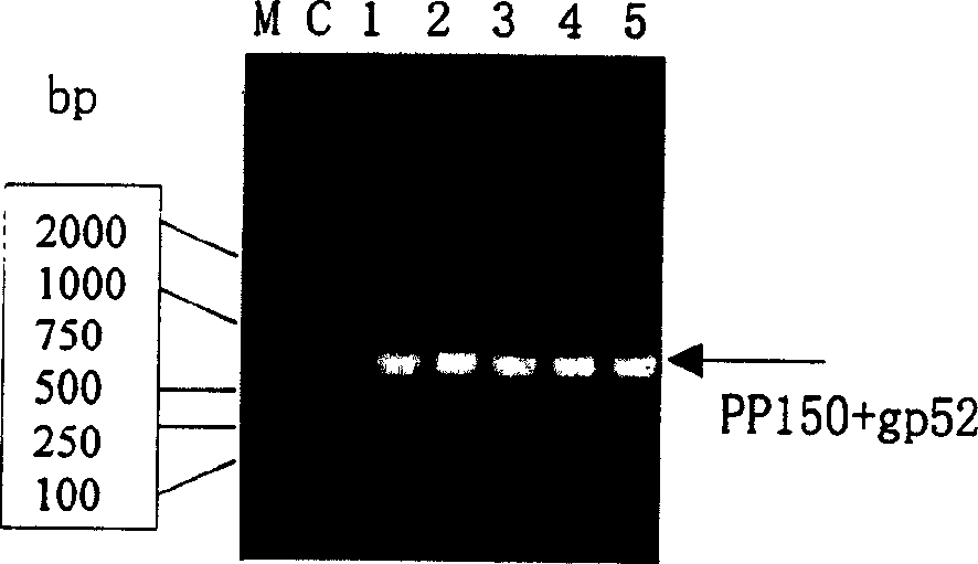 Recombination human cytomegalovirus fusion protein and its preparing method, application