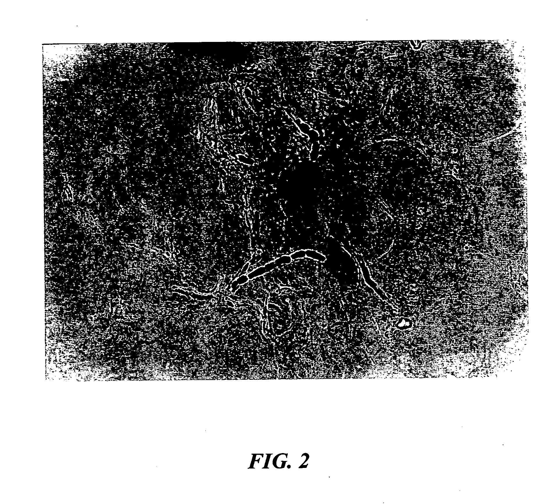 Microorganism staining agent and use thereof