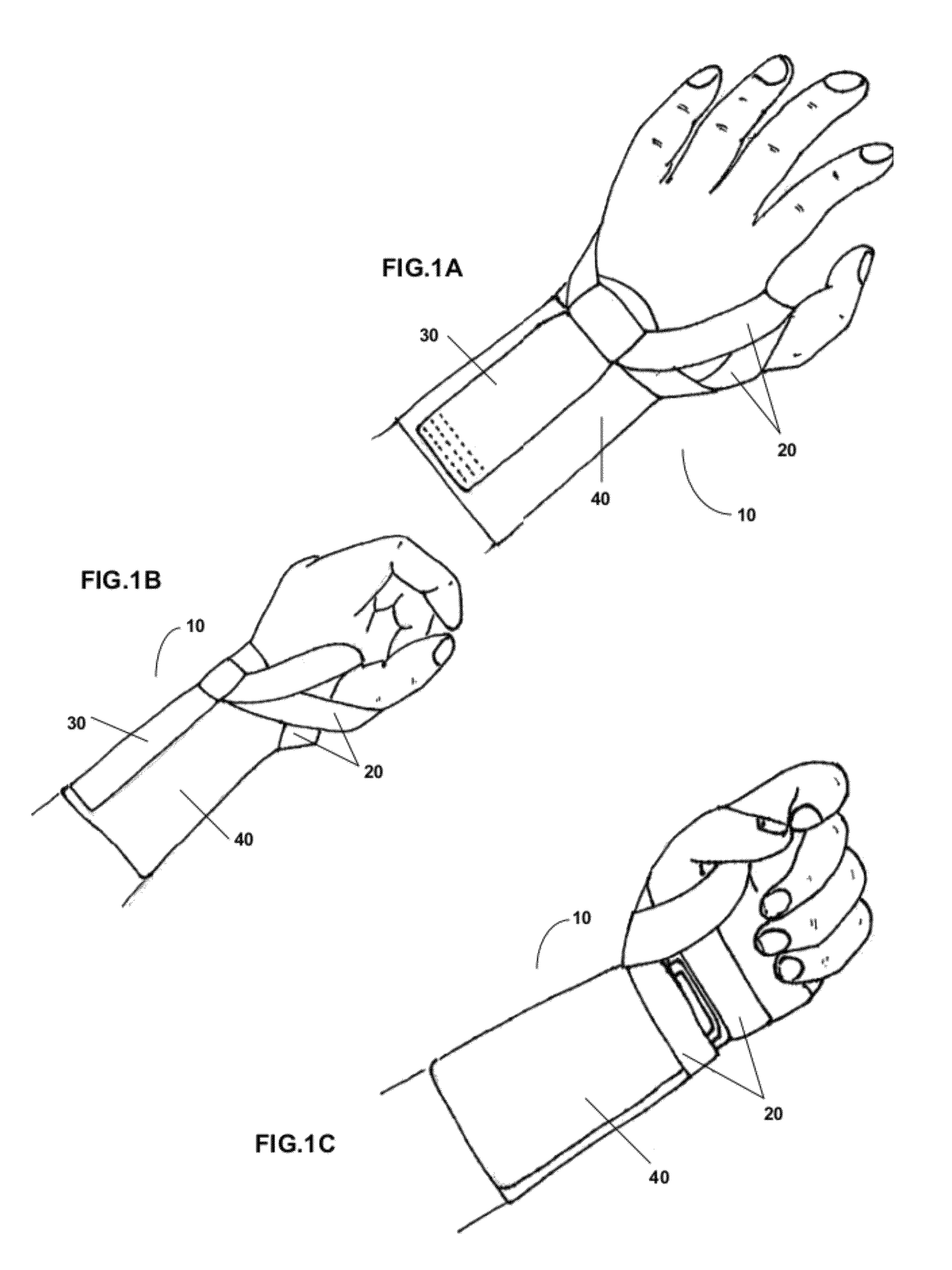 Modular upper extremity support system